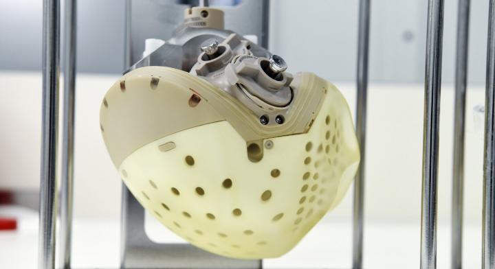 Most Advanced Artificial Heart Approved For Sale in Europe, Rais